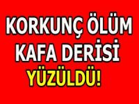 Korkunç ölüm kafa derisini yüzdü!