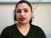 Estetik uzmanı kuaför çıktı!