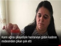 Karın ağrısı şikayetiyle hastaneye giden kadının midesinden çıkan şok etti