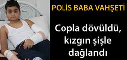 POLİS MEMURU OĞLUNU HASTANELİK ETTİ