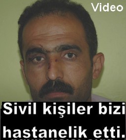 BİZİ TAKİP EDİP SONRA DA TARADILAR