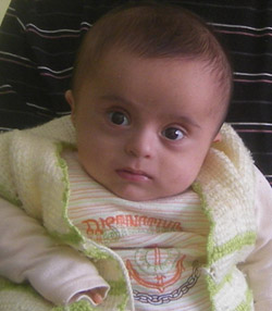 6 AYLIK EFE TEDAVİ OLMAK İSTİYOR