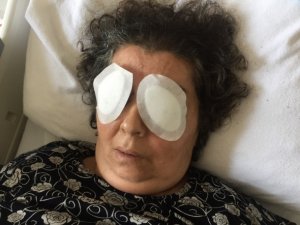 Şizofren kadın, bir hastanın gözlerini çıkardı