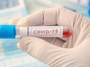 Covid-19'a karşı dirençli kan grupları