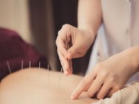 Akupunktur Terapisi ile Ağrı Yönetimi ve Stres Azaltma