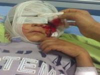 Hakkari'de bir çocuk yaralandı