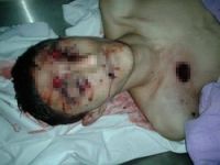 Amed'de 16 yaşındaki çocuk öldürüldü
