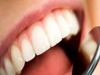 Diş Protez Bakımında10 Önemli Adım